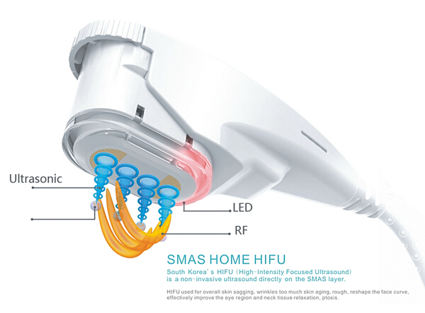 anti--gaing hohe Intensität HIFU fokussierte Schallsystemhautverjüngung tragbare hifu Maschine