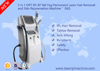 Schönheits-Ausrüstungs-Laser-Tätowierungs-Abbau der Klinik-Haut-Verjüngungs-Schönheits-Ausrüstungs-/IPL