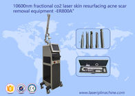 10600nm kühlen Strahln-Bruchco2-Laser-Maschine für Akne-Narben-Dehnungsstreifen-Abbau ab