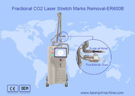 CO2-Laser-Maschine des Narben-Abbau-Scannen-10600nm 10x10mm Bruch
