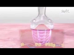 Vakuum-Rf-Ultraschallcellulite verringern der Hohlraumbildungs-MLS05 tragbares 40K Gerät