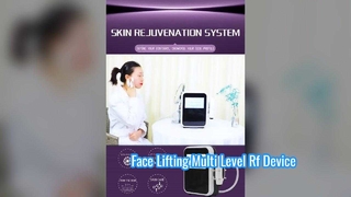 Nicht-invasives 60-W-Radiofrequenzgerät für die Augenpflege zur Glättung feiner Linien auf mehreren Ebenen