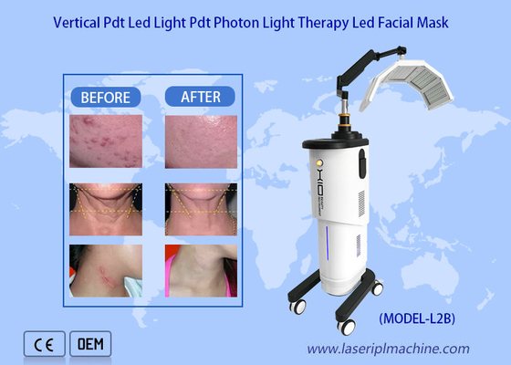 Neueste Bio-Lichttherapie Hautverjüngung 650nm Photodynamische Maschine