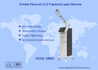 Vertikalfraktionierte CO2-Lasereinrichtung Pigmententfernung Narbenentfernung
