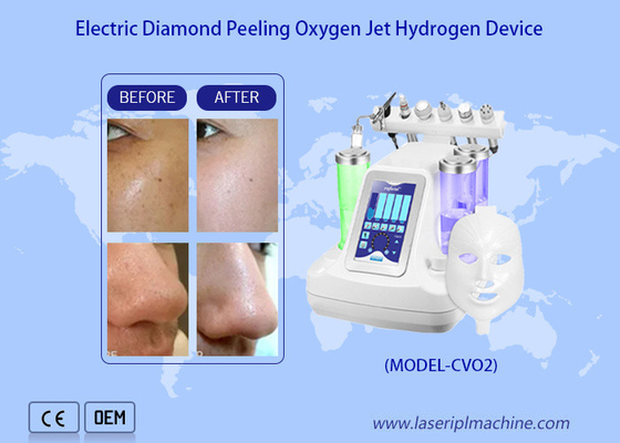 Wasser-Sauerstoffstrahl-Peeling-Maschine / Hydro-Dermabrasion Wasser-Sauerstoffstrahl-Tiefe Hautreinigung
