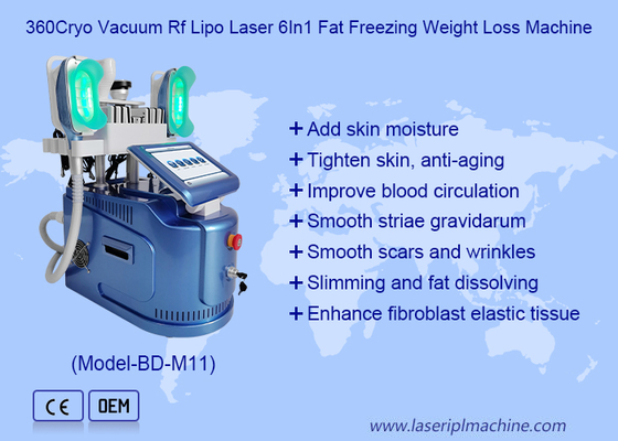 Tragbares Cryolipolysis, das Maschine, Salon-fette einfrierende Fettabsaugungs-Maschine abnimmt