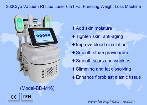 Tragbares cryolipolysis fette Frostausgangs-cryolipolysis Fettabsaugungsmaschine