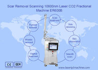 Bruch-CO2 10600nm Laser-Maschine für die Haut-Erneuerung