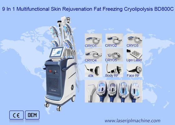 Hohlraumbildung 40K Rf Lipo Laser Cryo, das Maschine abnimmt