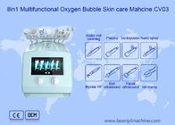 8 in 1 Multifunktionssauerstoff-Blase der Zohonice-Hautpflege-Schönheits-Maschinen-110v