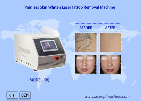 Guter Preis 1320nm 1064nm 532nm Portable Nd Yag Laser Tattoo Removal Hautbleichmaschine Online