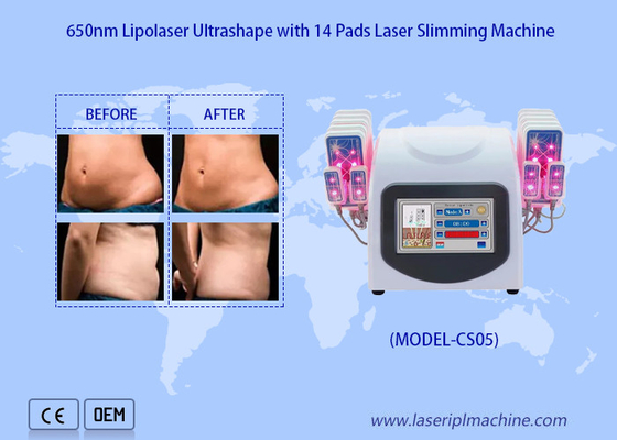 650nm Lipo Laser füllt Laser-Fettabsaugungs-Maschine für verringern Cellulite-fetten Abbau auf