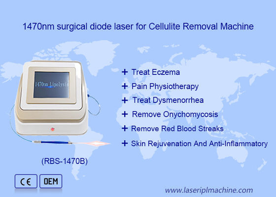Guter Preis 1470nm 980nm Diodenlaser Lipolyse Chirurgie Lasergerät Fettlöslich Online