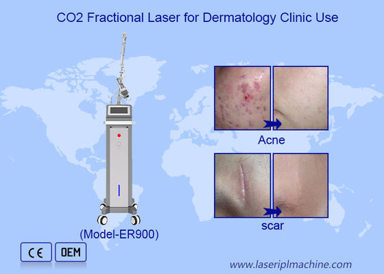 Guter Preis 10600nm Fractional Ultrapulsed Co2 Laser Hautwiederherstellungsmaschine Online