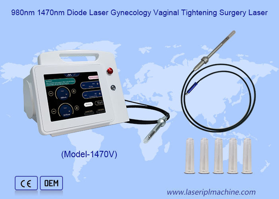 980nm 1470nm Diodenlaser  Gynäkologie  Vaginal  Straffung  Chirurgie Laser