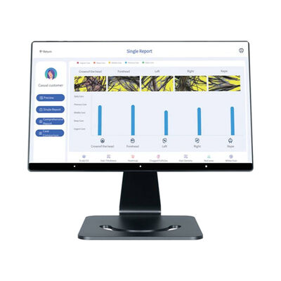 4 Sprachen Intelligenter KI-Kopfhautanalysator Haarkopfhautpflege Gezieltes Kopfgerät